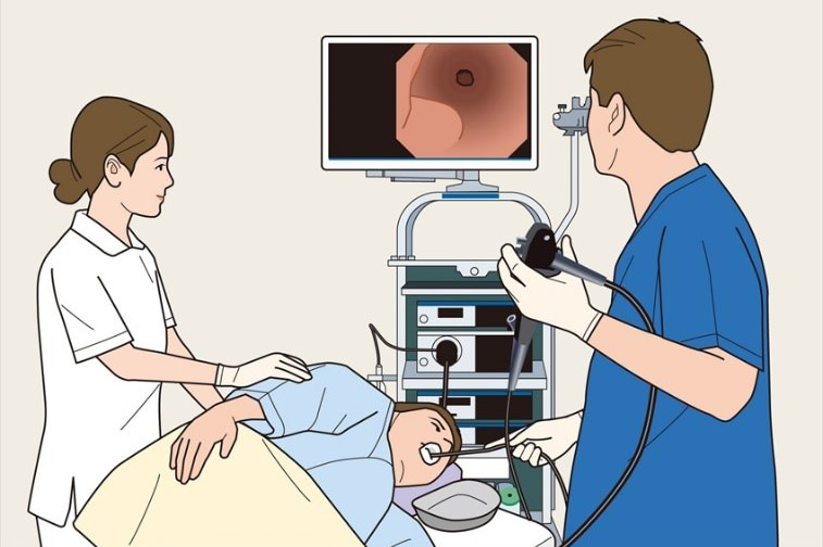 胃内視鏡検査(胃カメラ)検査の流れ